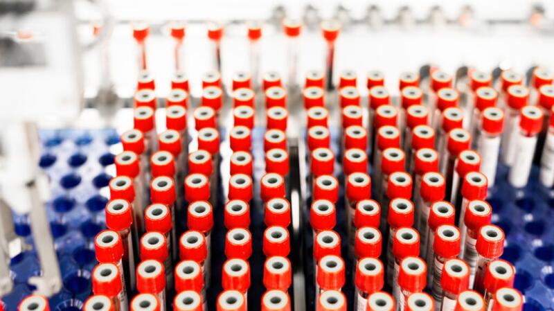 There are rows of blood vials.