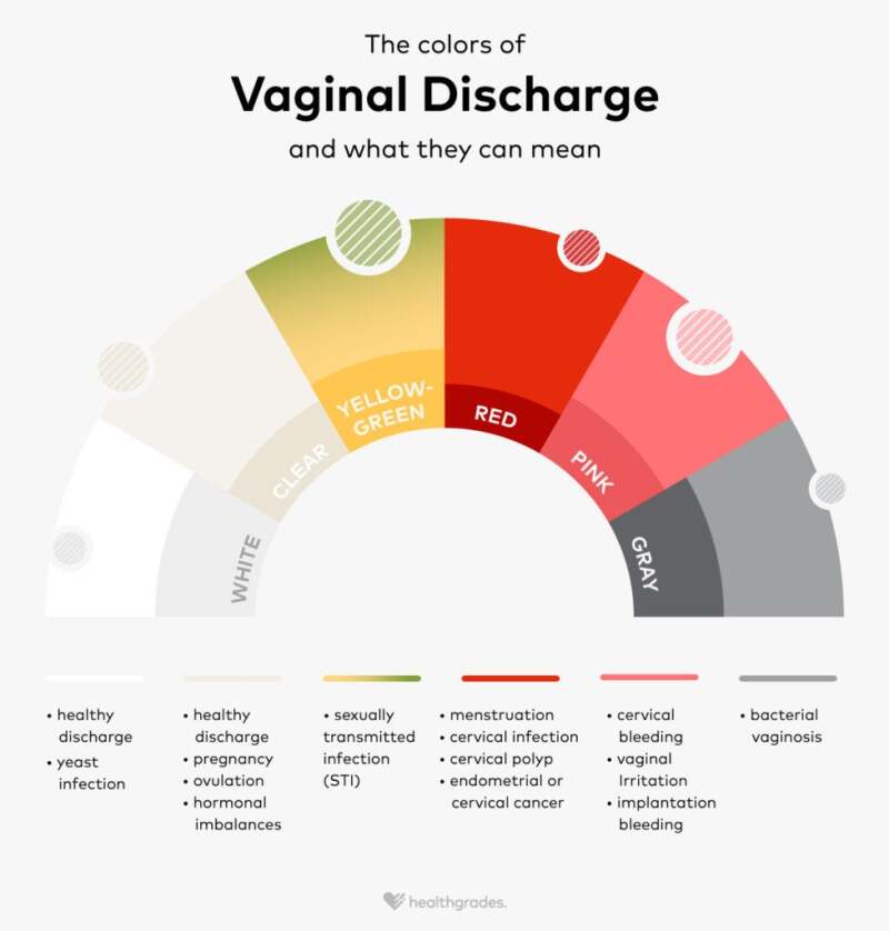 brown vaginal discharge before period