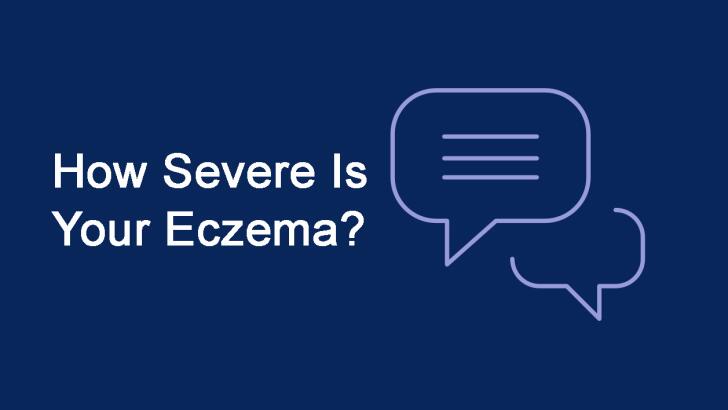 How Stress Affects My Eczema Managing Stress To Manage Eczema