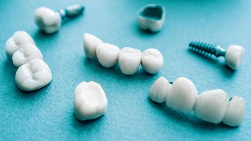 dental implant model