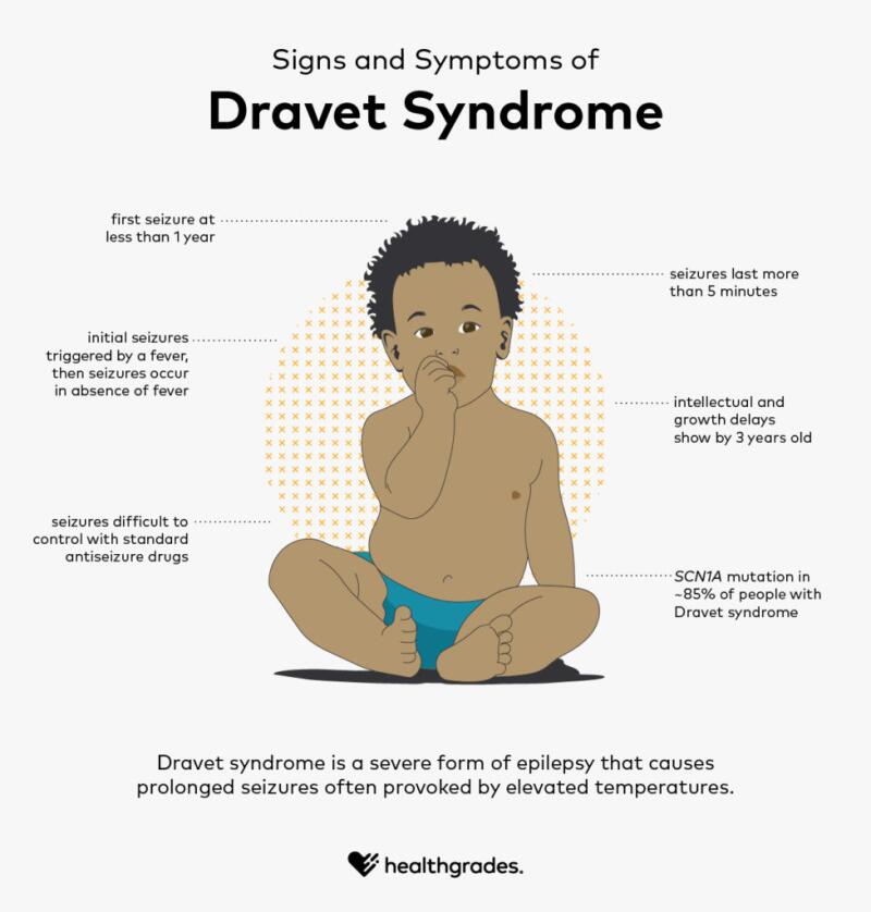 Dravet syndrome child The Immunological Tension: Safety vs. Efficacy