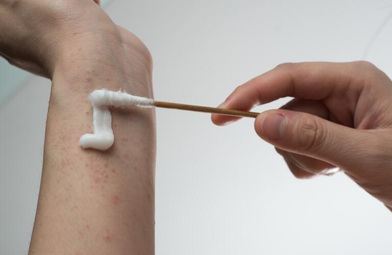 Allergy Ill Skin With Drug