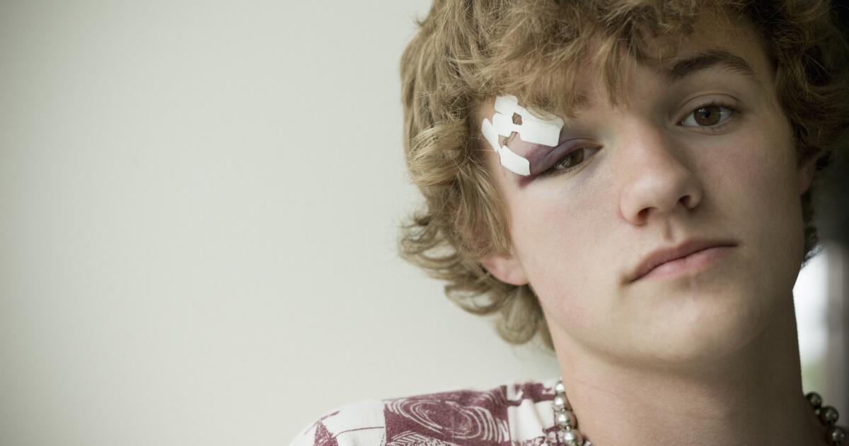 Eye Swelling Symptoms Causes Treatments