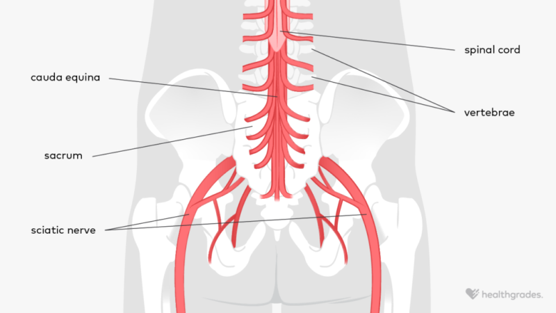 illustration of cauda equina, spinal cord, vertebrae, sacrum, and sciatic nerves