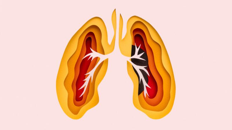 There is a conceptual picture of lungs.