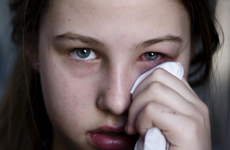 Pink Eye