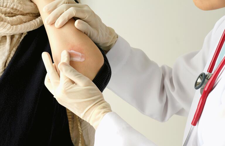 dermatologist applying cream to atopic dermatitis (eczema) on patient's forearm