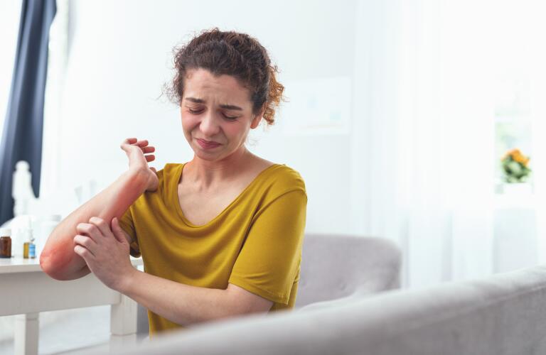 Young Caucasian woman scratching redness on arm from eczema or atopic dermatitis