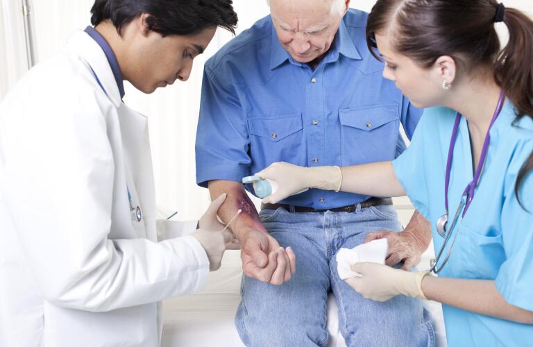 How To Treat Burns Burn Blisters Burns First Aid Treatment