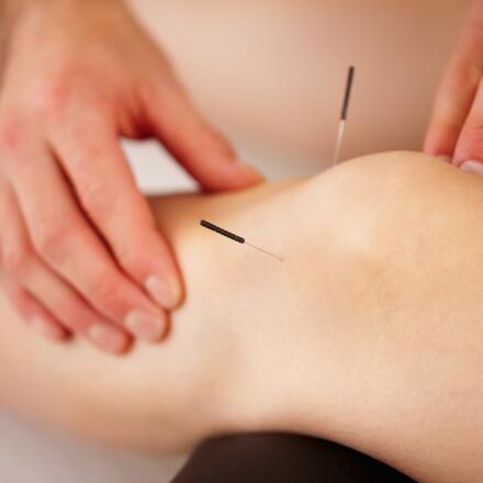 If you're looking for an alternative treatment to alleviate RA pain, acupuncture may help.
