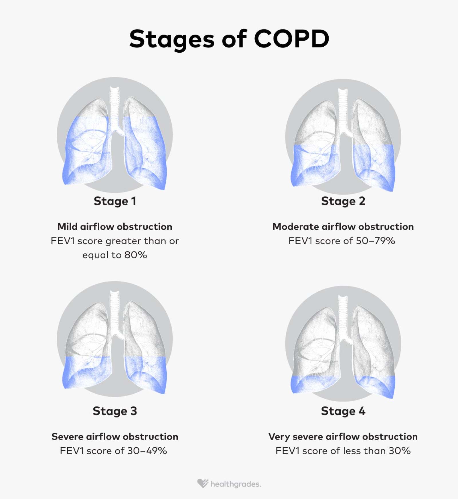 COPD Stages Symptoms, Treatments, and More