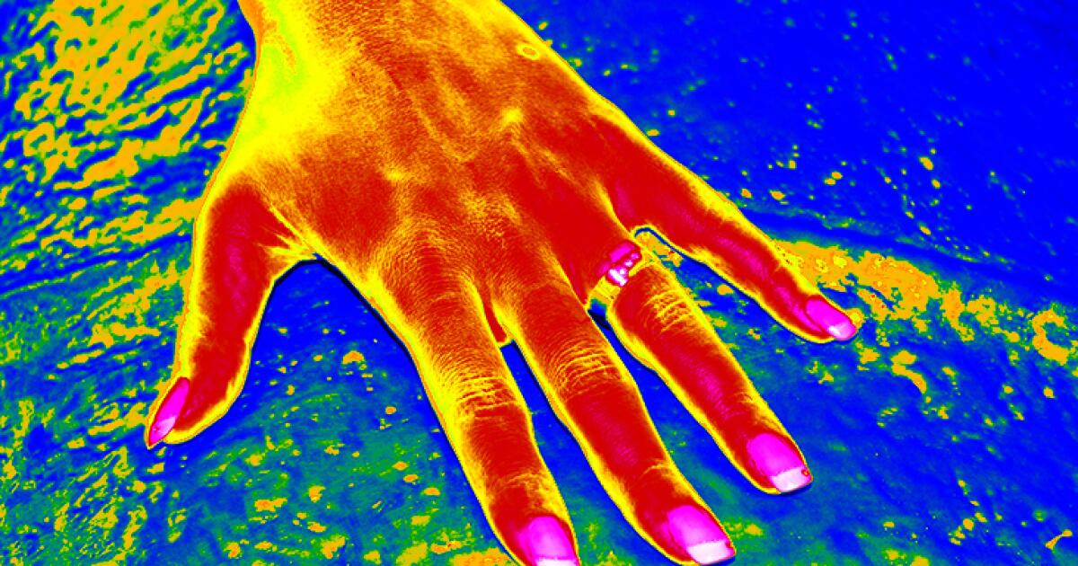 Thermography Scan: Uses Risks Costs and Cautions Thermography Scan: Uses Risks Costs and Cautions