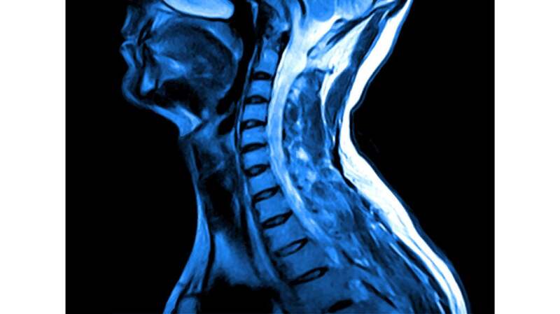 A medical image showing an imaging scan of the vertebrae of the neck.