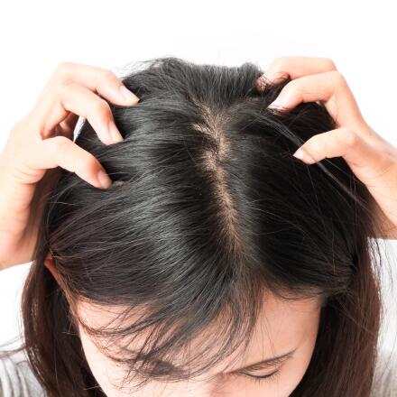 While psoriasis on your scalp can be itchy and uncomfortable, it’s treatable.