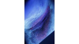 Erythrasma: Types, Causes, and Treatments