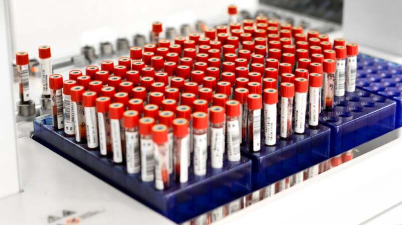 Tuberculosis Test: Methods, Results, Risks, and More