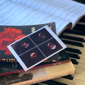 Jessica Hanson_Graves' Disease_ A Thyroidectomy_ But I'm a Singer