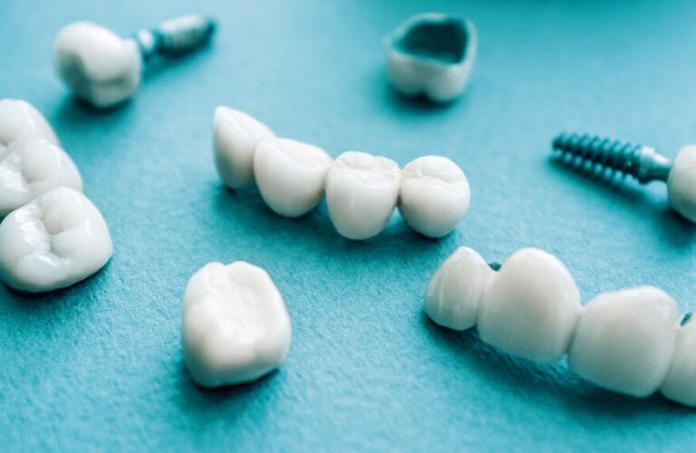 dental implant model