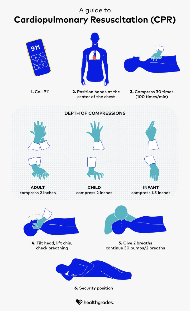 Cardiopulmonary Resuscitation (CPR) Steps and Certification