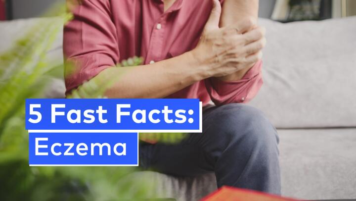 5 fast facts eczema