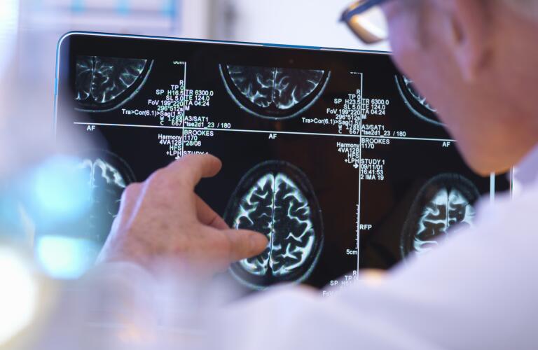 radiologist assessing CT brain scan