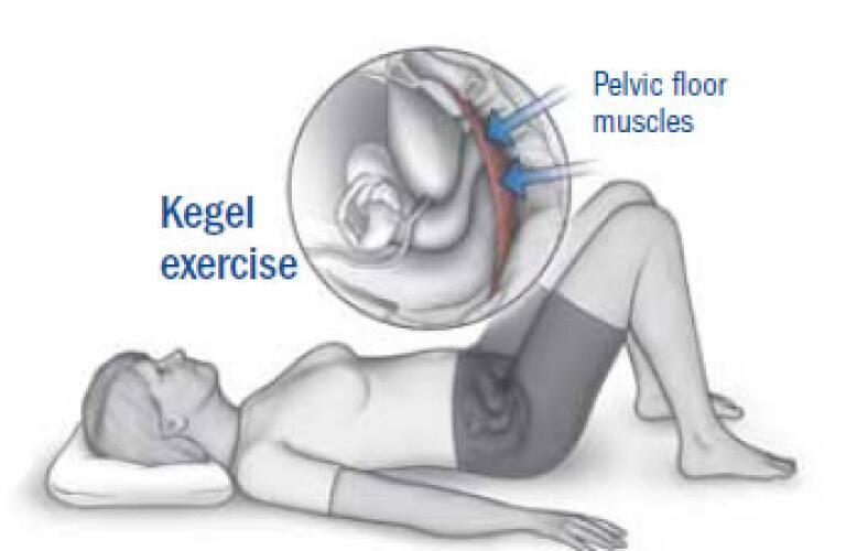 Kegel Exercises Benefits