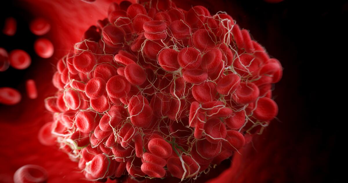 A Big Image Of An Old Dried Red Blood Clot Stock Photo, Picture and Royalty  Free Image. Image 1288955.