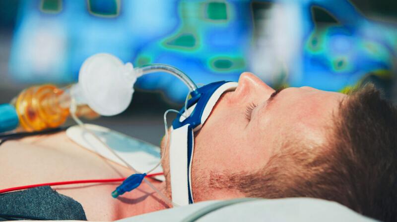 An intubated man