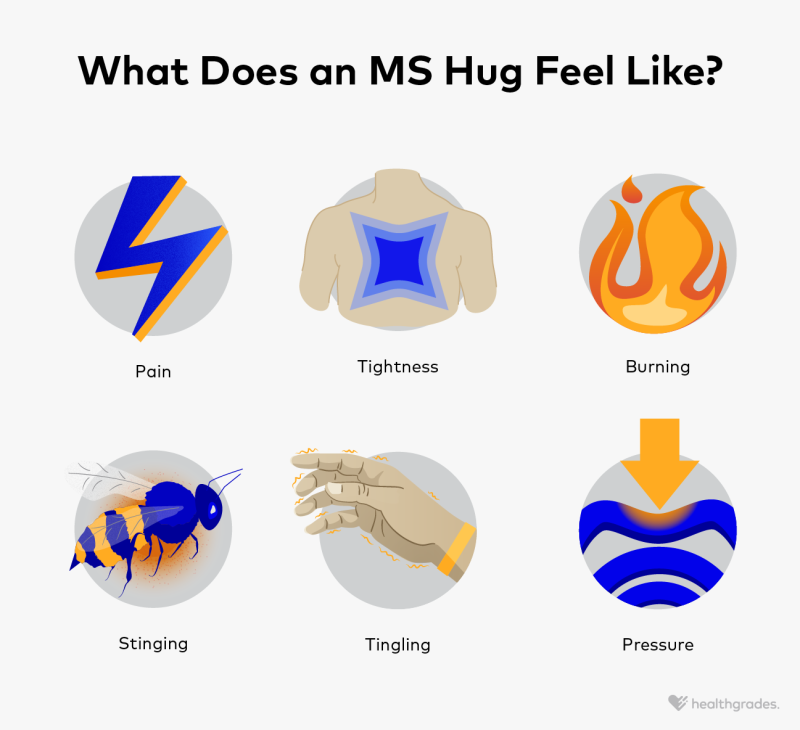Hug And Feel MS Hug: Symptoms, Duration, Causes, and Management