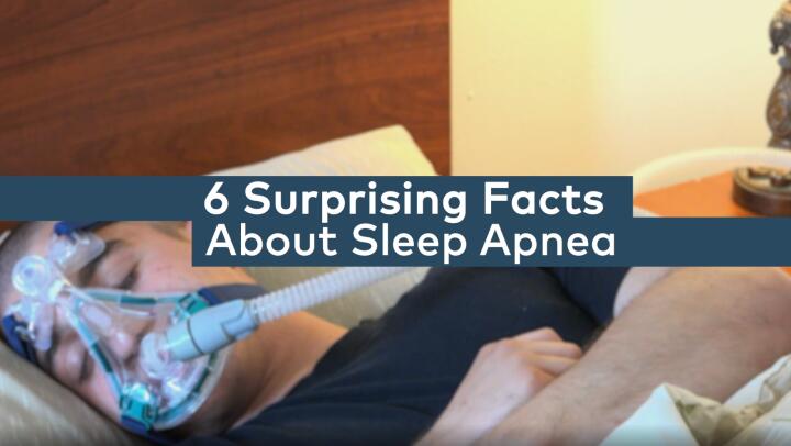 6 surprising facts about sleep apnea