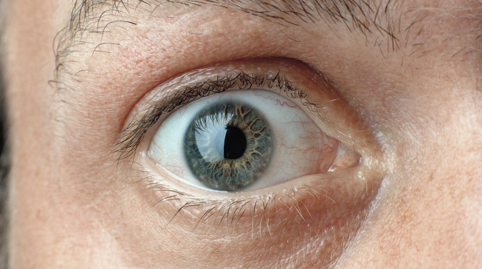 8 Things to Know About Graves’ Disease Symptoms, Causes & Treatment