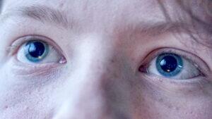 dilated pupils weed