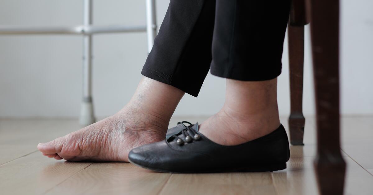 Foot Swelling Symptoms Causes Treatments Prevention Foot Swelling Symptoms Causes Treatments Prevention