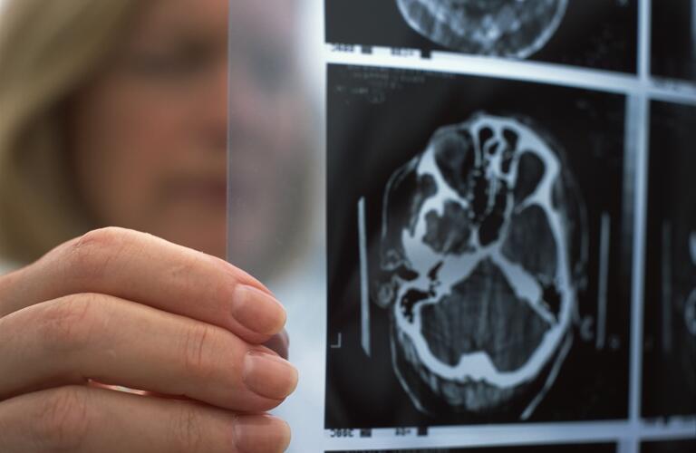 Caucasian female doctor or technician looking at brain scan