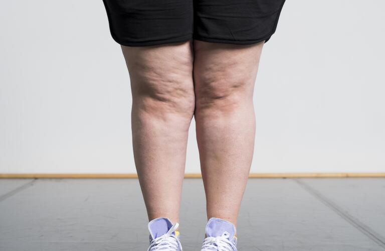 profile-of-womans-legs