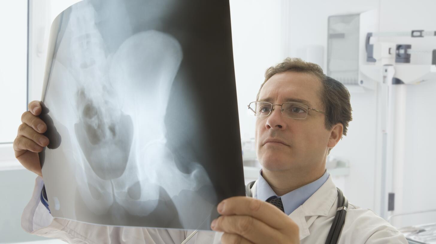 6 Things to Know About Bursitis Causes, Symptoms &amp; Treatment