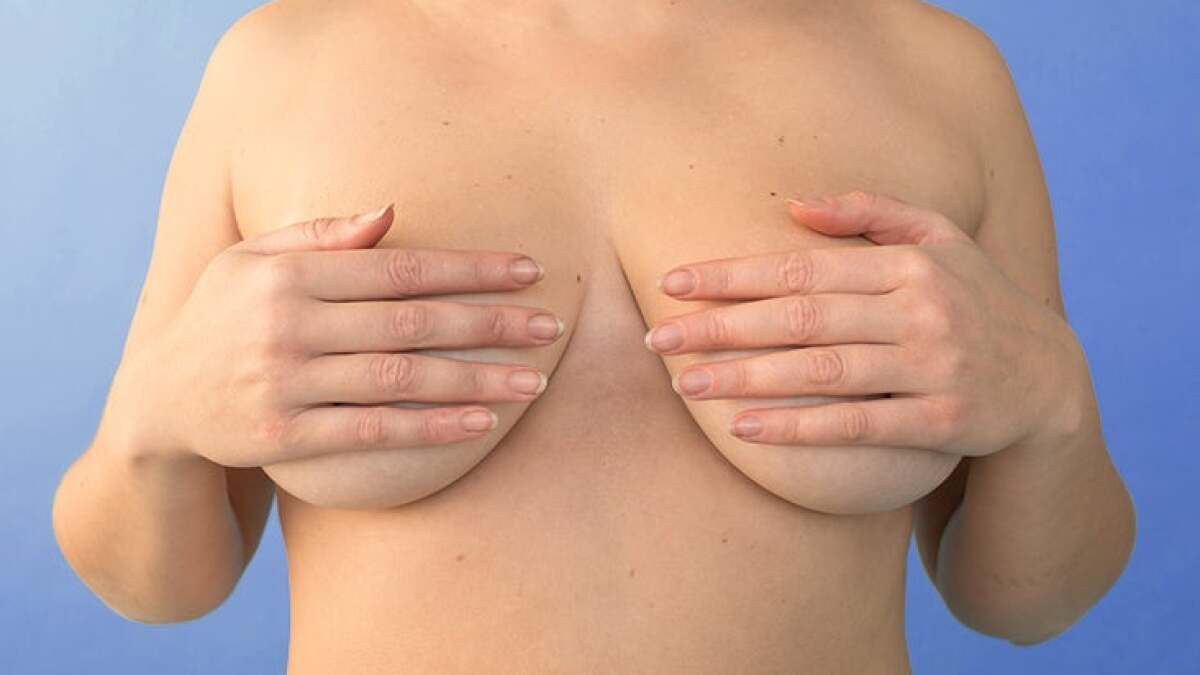 Breast Cancer Dimpling: Causes, Symptoms, Pictures