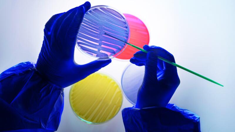 Hands holding a microscopic sample and a swab