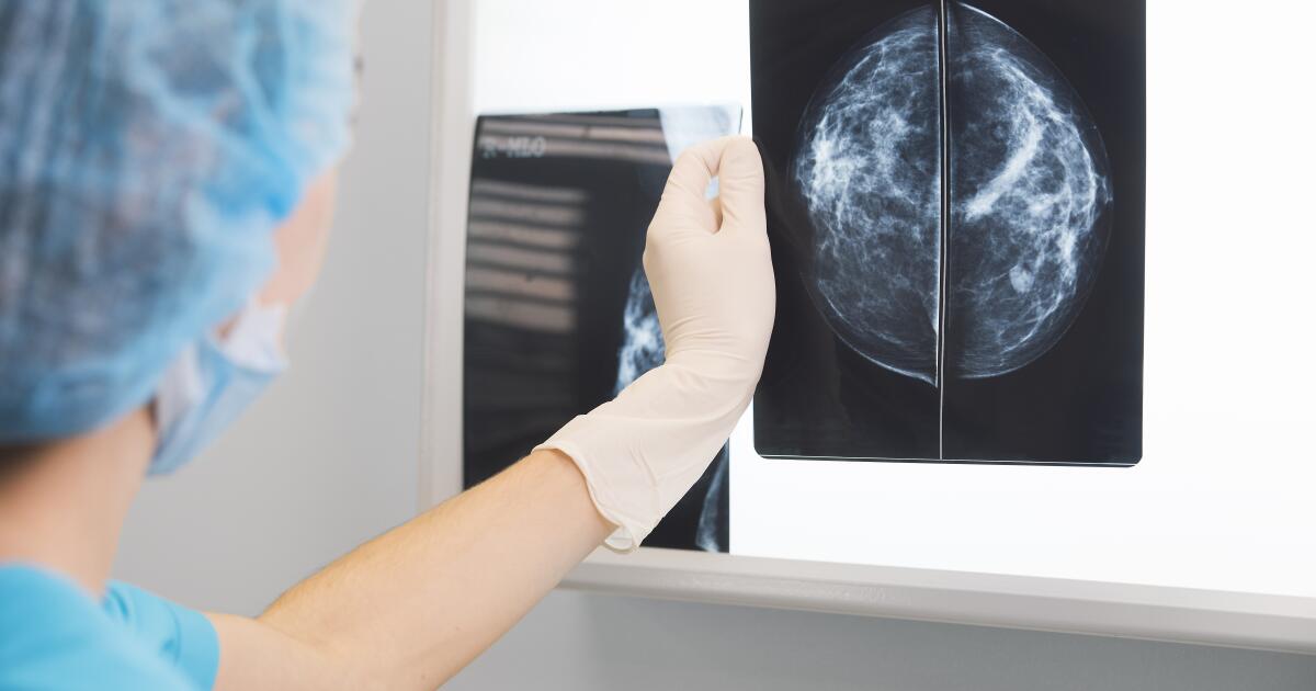 What Is a Breast Cyst? | Breast Cyst Symptoms, Causes & Treatment