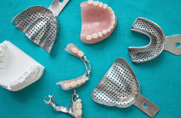 picture of molds and casts of teeth alongside dentures