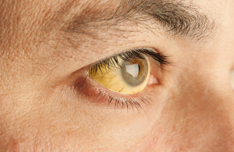 yellow eyes