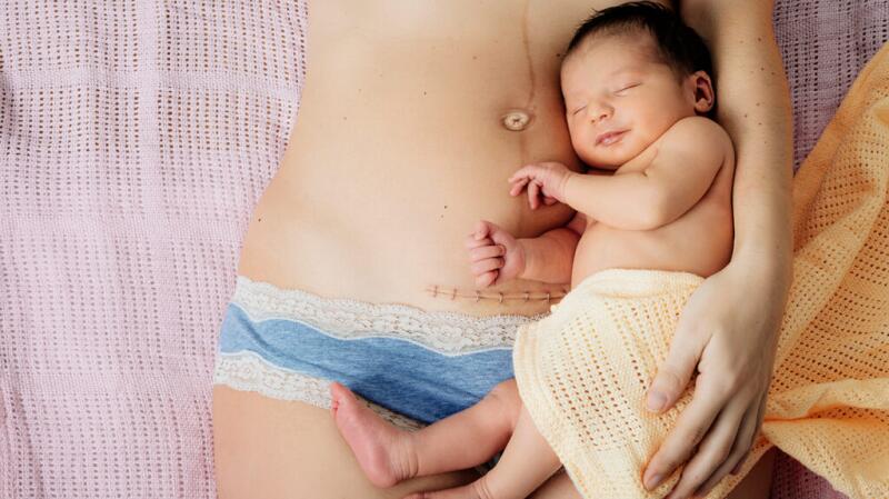 Overhead view of baby against mother's belly with visible C-section scar