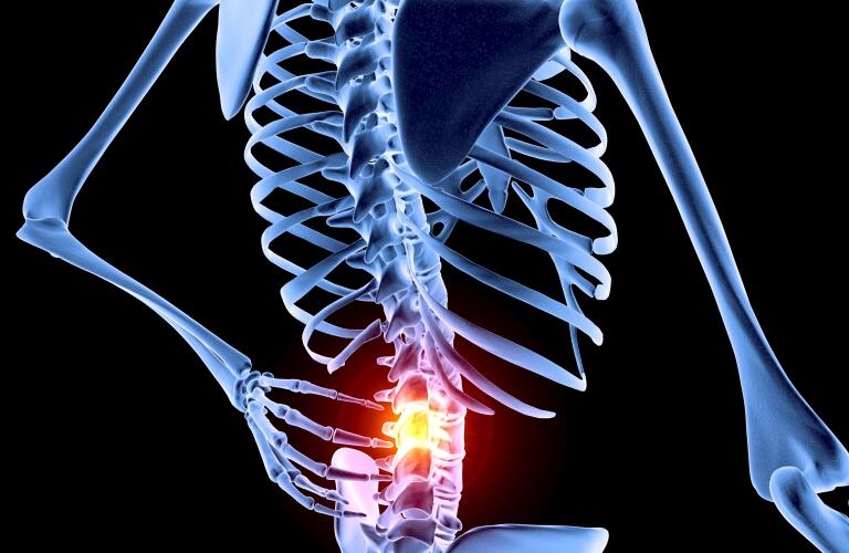 Back-pain