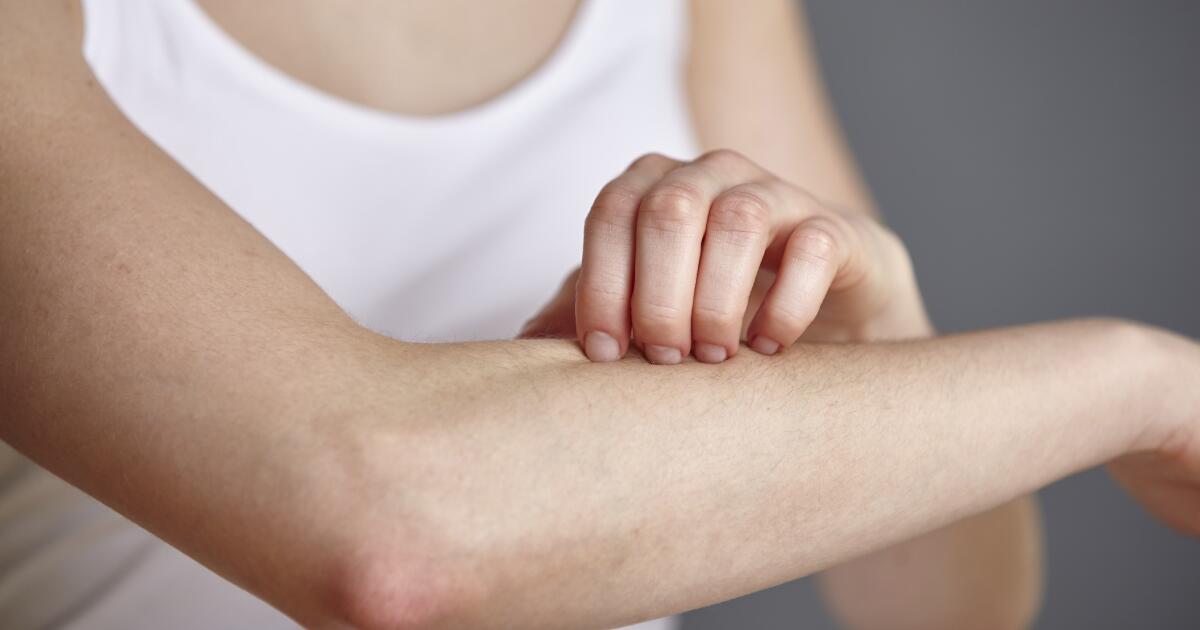 Allergic Reaction, Shingles & More | When to See a Doctor for a Rash