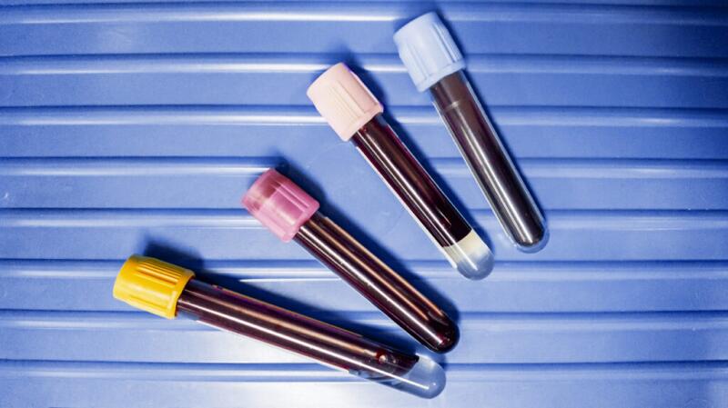 Blood test tubes against a purple background
