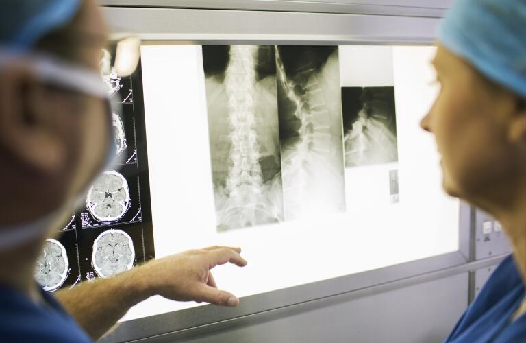 doctors-discussing-x-ray-of-spine