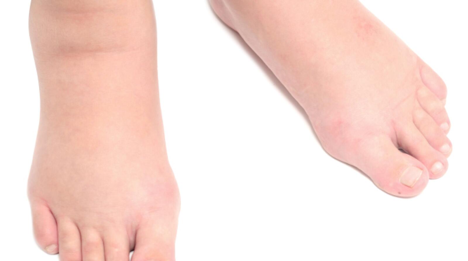 7 Reasons for Wearing Compression Socks