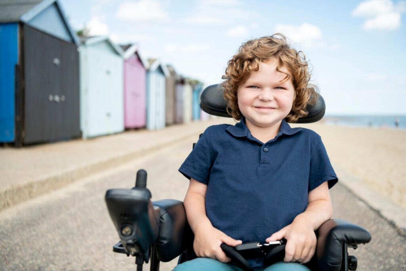 What Is the Prognosis of Duchenne Muscular Dystrophy?