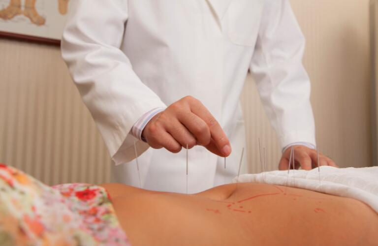 Inserting acupuncture needles