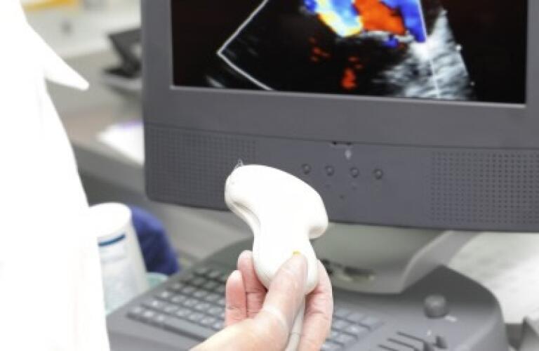 intravascular ultrasound proc a1 460x261 stk 125960438